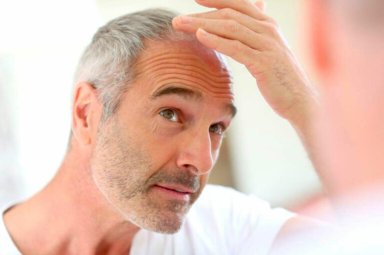 Essential vitamins for preventing hair loss