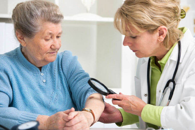 5 silent signs of skin cancer to watch out for