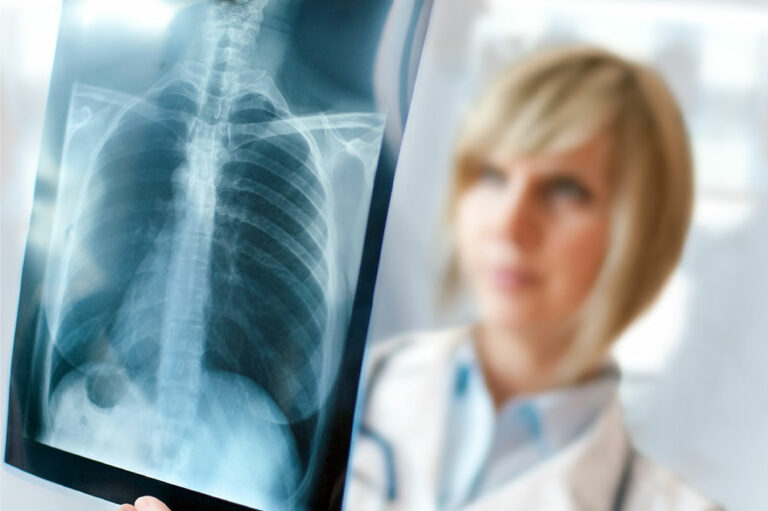 Types and early signs of lung cancer